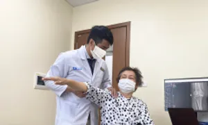 Thay khớp đảo ngược bởi xương vai gãy nát